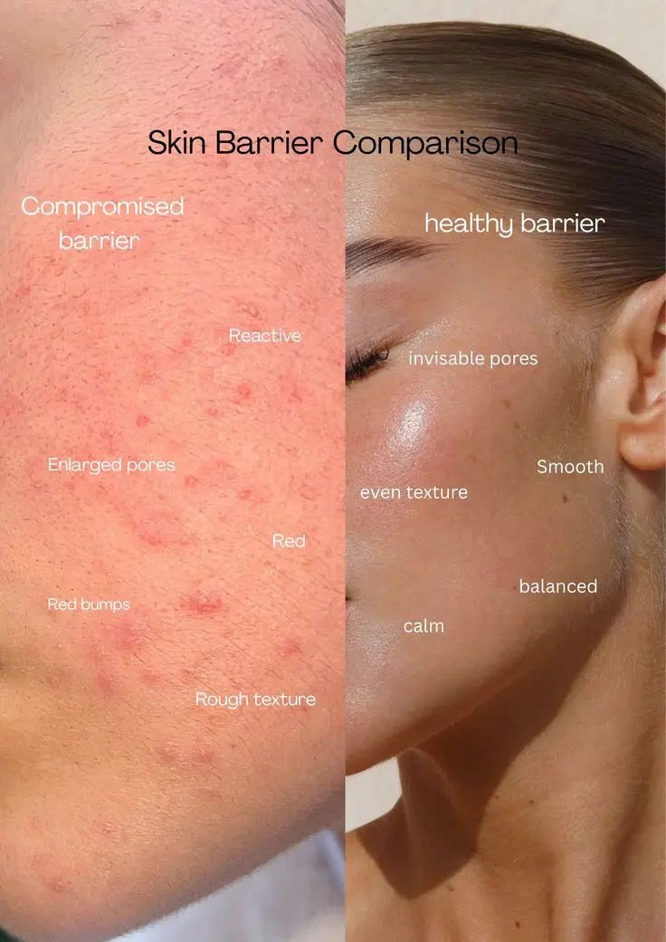 AMAZIA compromised skin barrier vs healthy skin barrier diagram Pakistan hard water