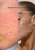 Why Pakistani Water Damages Skin Barrier | AMAZIA Skincare